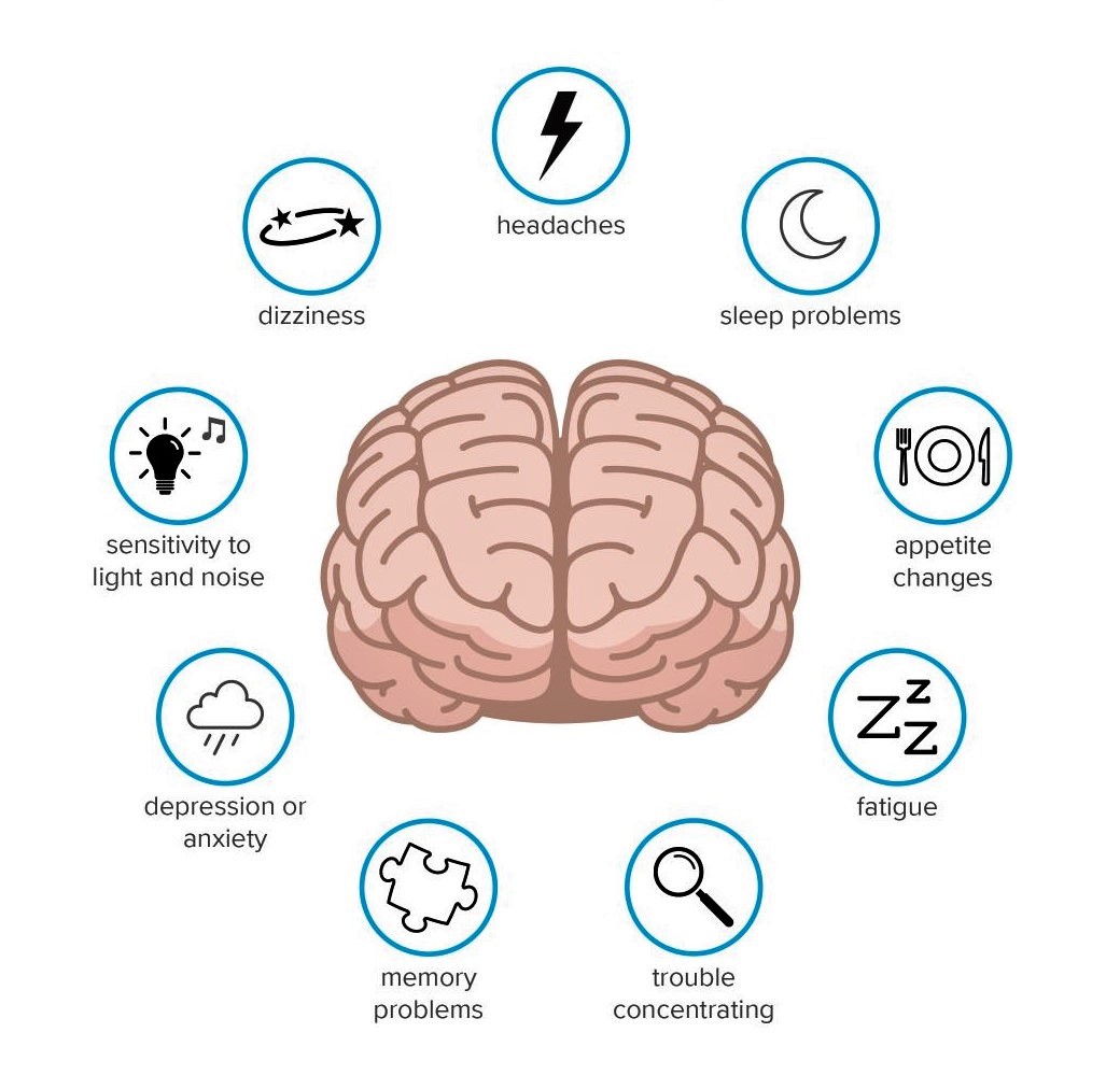 concussion infographic